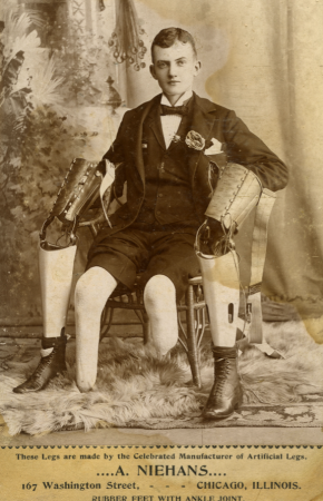 A Victorian-era male posing with two prosthetic legs
