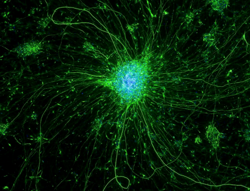 Neurons in a Dish