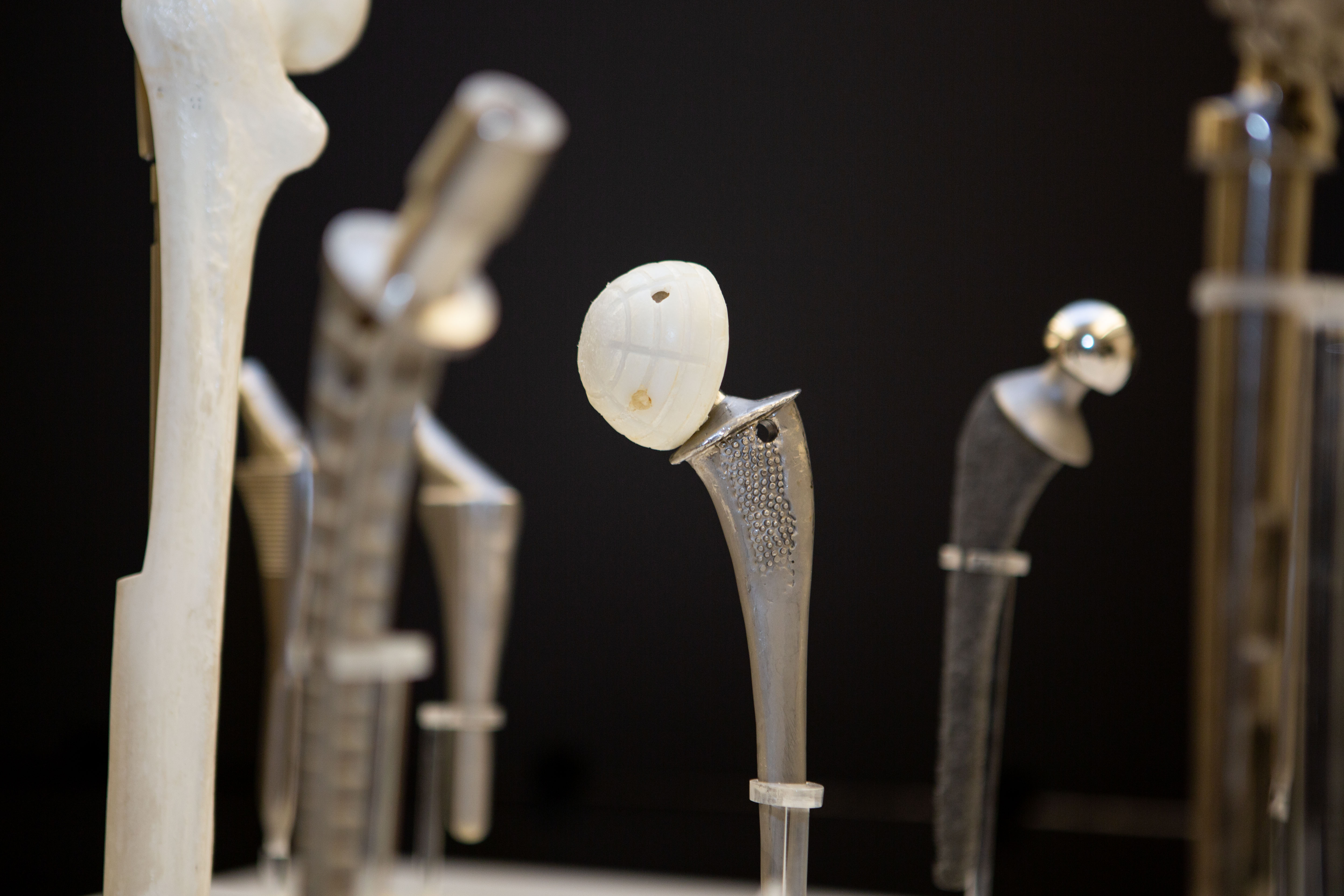 The Evolution of Total Hip Replacement