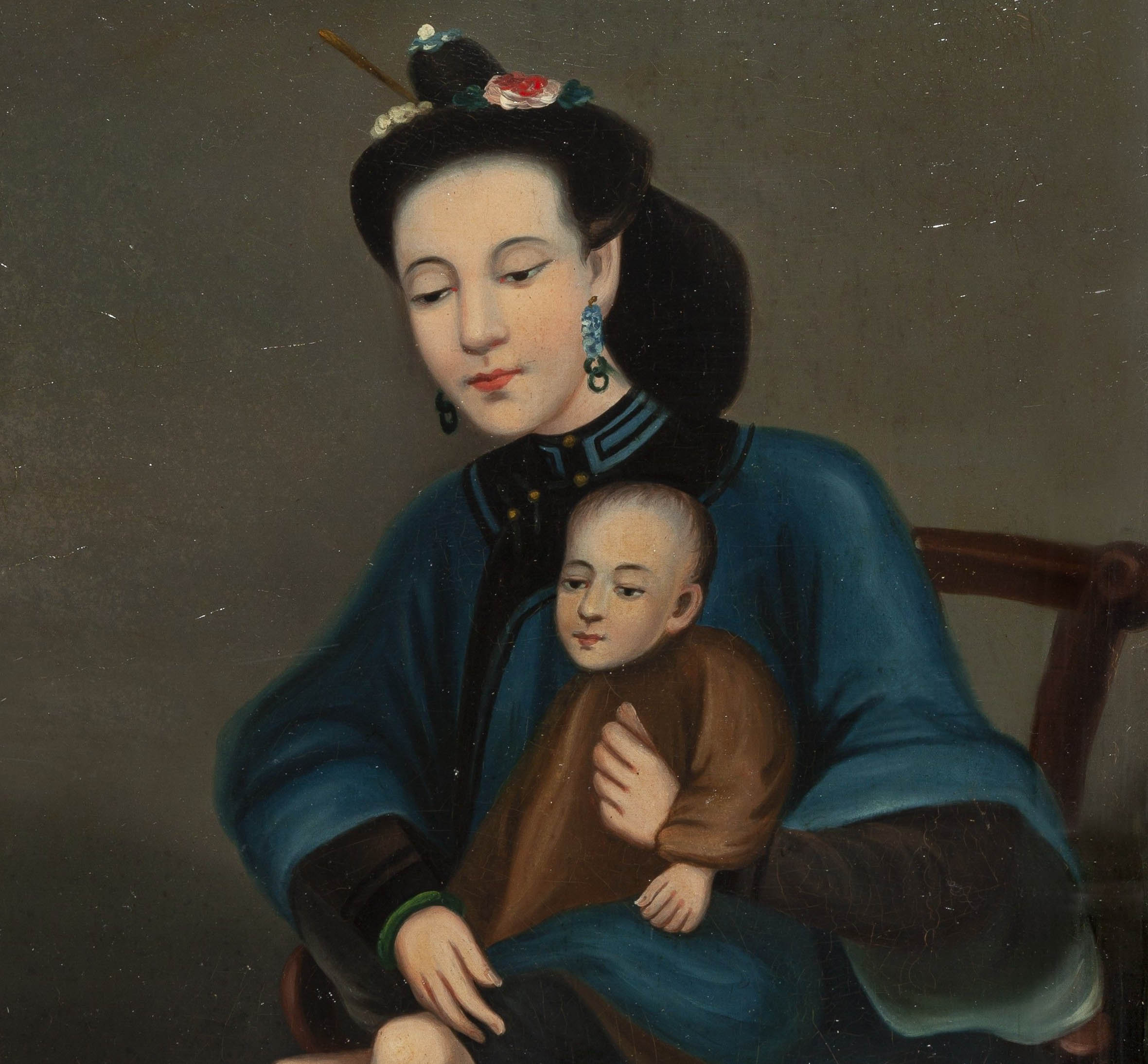 Woman, elegantly dressed and coiffed, holding her daughter. Gangrene of feet