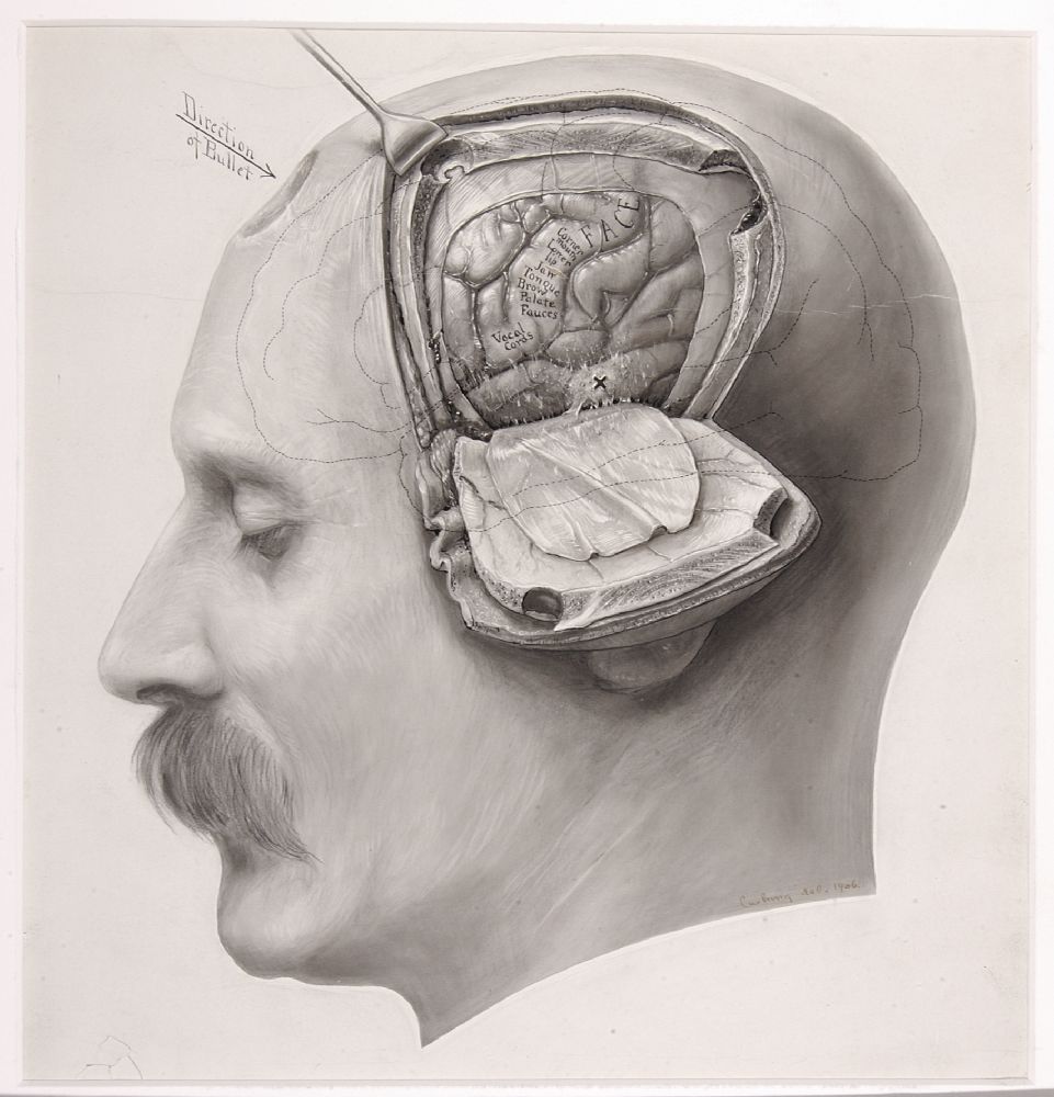 illustration of a face with a flap open to show the brain