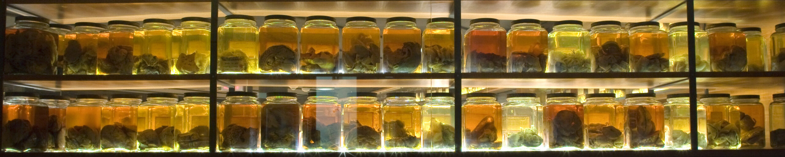 brain specimens in jars